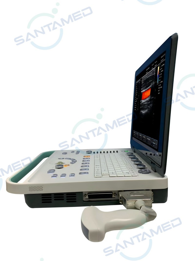 2D Ultrasound Scanner